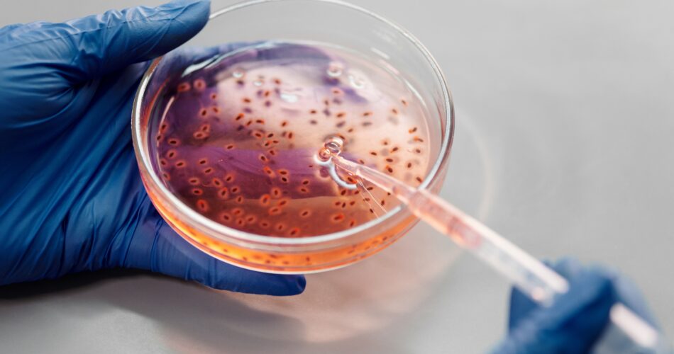 Salmonelle, listeria... que se passe-t-il dans l'agroalimentaire en Europe