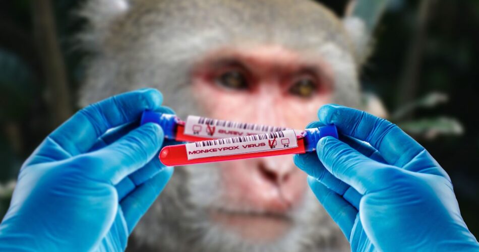 Vers une nouvelle crise sanitaire la variole du singe